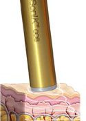 VitaSoniK COS 100% Made in Germany Anti Aging Anti Falten Kosmetik Körper Gesicht Ultraschallgerät Ultraschall - 1